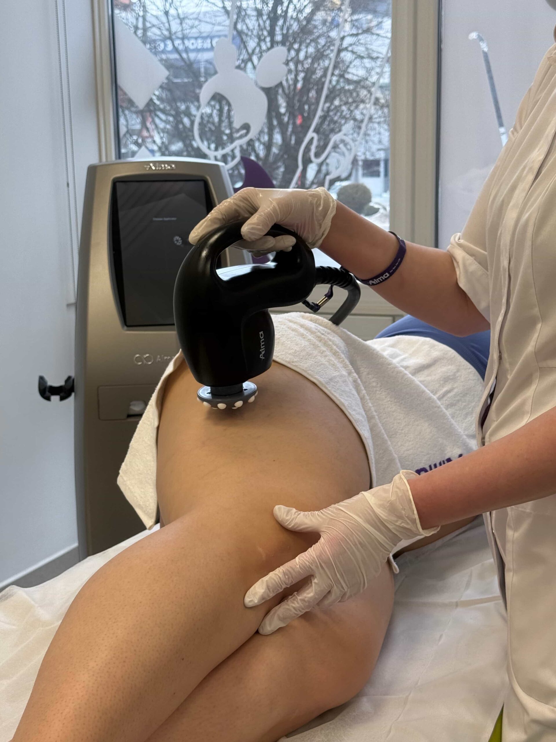 Униполярный RF лифтинг </br>Uni Body Alma PrimeX